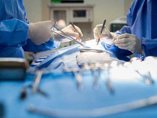 Chirurgia naczyniowa - czym się zajmuje ta dziedzina wiedzy?