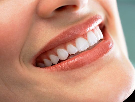 Jak dbać o biel zębów?