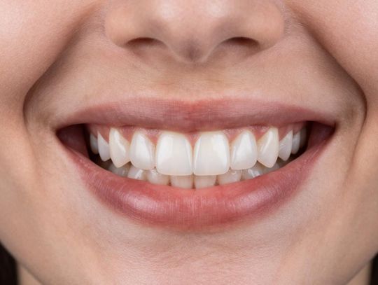 Licówki porcelanowe - dla kogo są odpowiednie i jak odróżnić dobry efekt od złego?