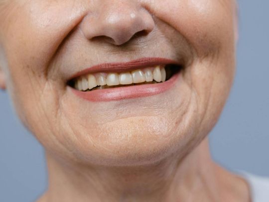 Proteza na implantach — poradnik: rodzaje, przebieg leczenia i pielęgnacja