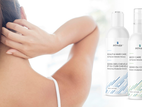 Szampon na łupież pstry - co warto wiedzieć?